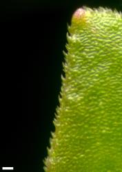 Veronica plebeia. Leaf margin. Scale = 0.1 mm.
 Image: P.J. Garnock-Jones © P.J. Garnock-Jones CC-BY-NC 3.0 NZ